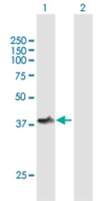 Western Blot: TOM1L1 Antibody [H00010040-B01P]