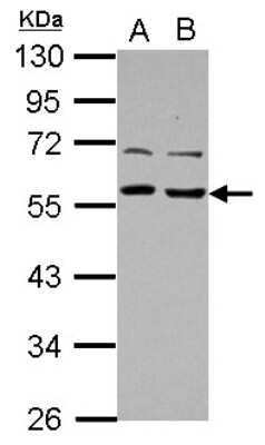 Western Blot: TOM1L1 Antibody [NBP2-20681]