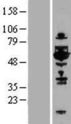 Western Blot: TOM1L1 Overexpression Lysate [NBP2-07742]