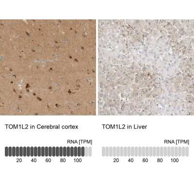 Immunohistochemistry-Paraffin: TOM1L2 Antibody [NBP1-86006]