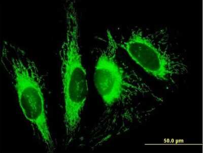 Immunocytochemistry/ Immunofluorescence: TOM70 Antibody [H00009868-B01P]