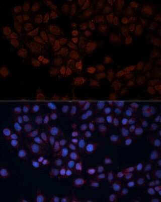 Immunocytochemistry/ Immunofluorescence: TOM70 Antibody - Azide and BSA Free [NBP2-94889]