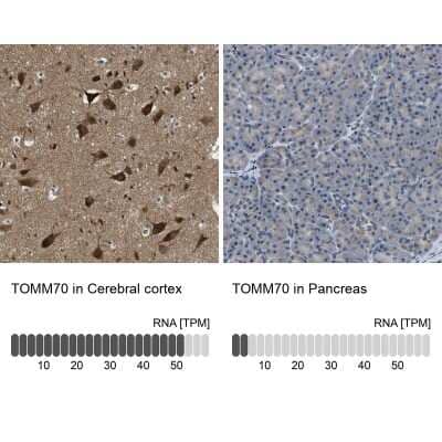 Immunohistochemistry-Paraffin: TOM70 Antibody [NBP1-87863]