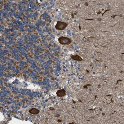 Immunohistochemistry-Paraffin: TOM70 Antibody [NBP1-87863]