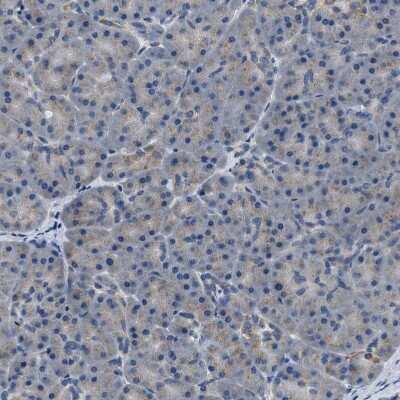 Immunohistochemistry-Paraffin: TOM70 Antibody [NBP1-87863]