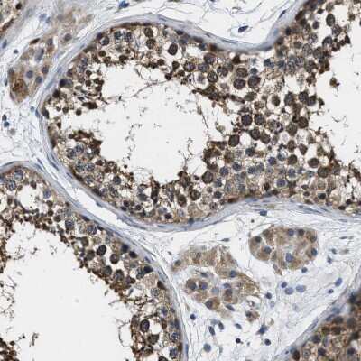 Immunohistochemistry-Paraffin: TOM70 Antibody [NBP1-87863]