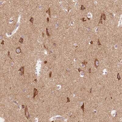 Immunohistochemistry-Paraffin: TOM70 Antibody [NBP2-38571]