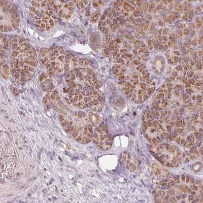 Immunohistochemistry-Paraffin: TOM70 Antibody [NBP2-38571]