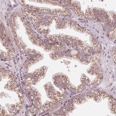 Immunohistochemistry-Paraffin: TOM70 Antibody [NBP2-38571]