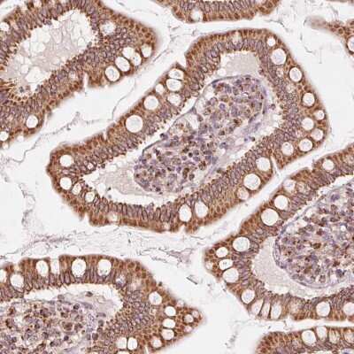 Immunohistochemistry-Paraffin: TOM70 Antibody [NBP2-38571]