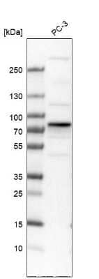 Western Blot: TOM70 Antibody [NBP2-38571]