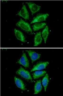 Immunocytochemistry/ Immunofluorescence: TOMM20 Antibody (1B2) - BSA Free [NBP2-60248]