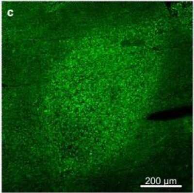 Immunohistochemistry: TOMM20 Antibody (4F3) [H00009804-M01]