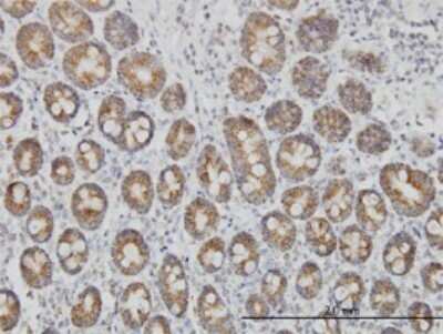 Immunohistochemistry-Paraffin: TOMM20 Antibody (4F3) [H00009804-M01]