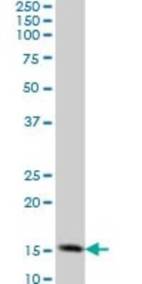 Western Blot: TOMM20 Antibody (4F3) [H00009804-M01]