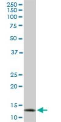 Western Blot: TOMM20 Antibody (4F3) [H00009804-M01]