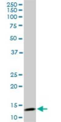 Western Blot: TOMM20 Antibody (4F3) [H00009804-M01]