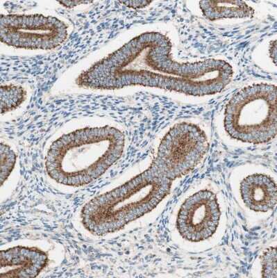 Immunohistochemistry-Paraffin: TOMM20 Antibody [NBP1-81556]