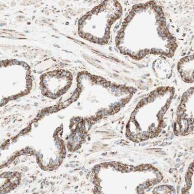 Immunohistochemistry-Paraffin: TOMM20 Antibody [NBP1-81556]