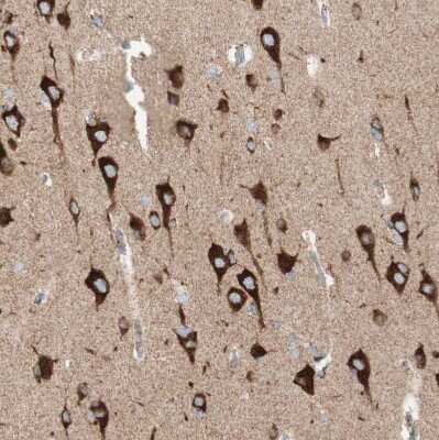 Immunohistochemistry-Paraffin: TOMM20 Antibody [NBP1-81556]