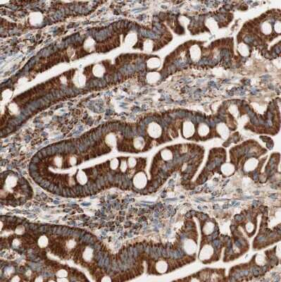 Immunohistochemistry-Paraffin: TOMM20 Antibody [NBP1-81556]