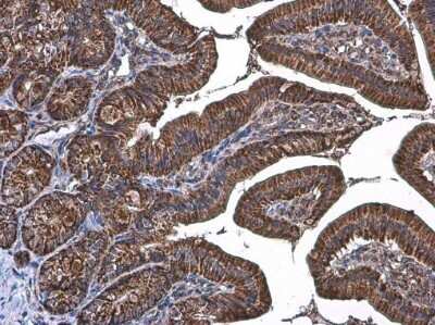Immunohistochemistry-Paraffin: TOMM20 Antibody [NBP3-13287]