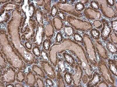Immunohistochemistry-Paraffin: TOMM20 Antibody [NBP3-13287]