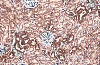 Immunohistochemistry-Paraffin: TOMM20 Antibody [NBP3-13287]