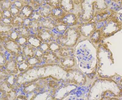 Immunohistochemistry-Paraffin: TOMM20 Antibody (ST04-72) [NBP2-67501]