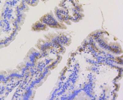 Immunohistochemistry-Paraffin: TOMM20 Antibody (ST04-72) [NBP2-67501]
