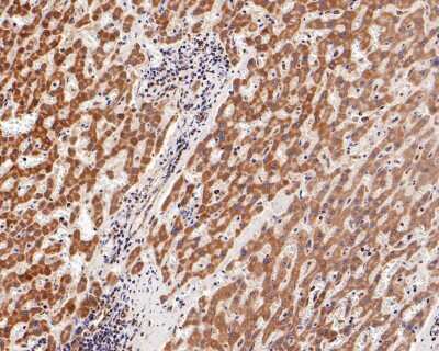 Immunohistochemistry-Paraffin: TOMM20 Antibody (ST04-72) [NBP2-67501]