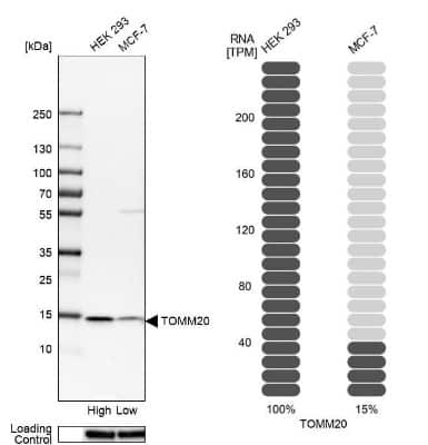 Western Blot: TOMM20 Antibody [NBP1-81556]