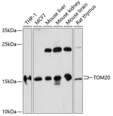 Western Blot: TOMM20 AntibodyAzide and BSA Free [NBP2-94821]