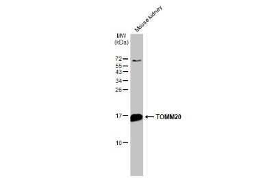 Western Blot: TOMM20 Antibody [NBP3-13287]