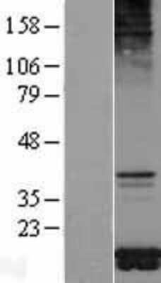 Western Blot: TOMM20 Overexpression Lysate [NBL1-17189]