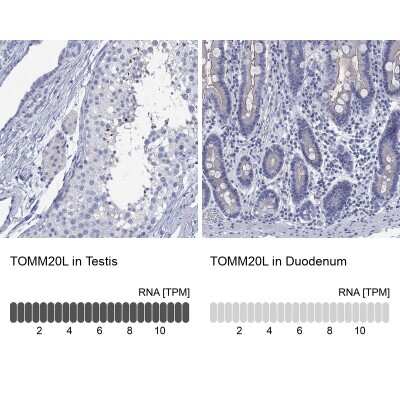 Immunocytochemistry/ Immunofluorescence: TOMM20L Antibody [NBP3-17145]