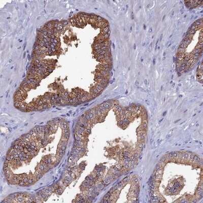 Immunohistochemistry-Paraffin: TOMM20L Antibody [NBP1-93437]