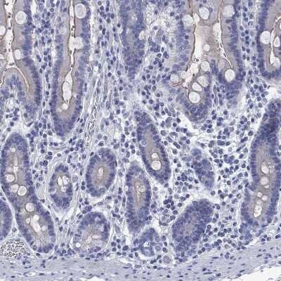 Immunohistochemistry-Paraffin: TOMM20L Antibody [NBP3-17145]