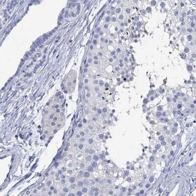 Immunohistochemistry-Paraffin: TOMM20L Antibody [NBP3-17145]
