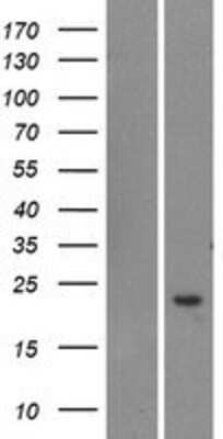 Western Blot: TOMM20L Overexpression Lysate [NBP2-04495]