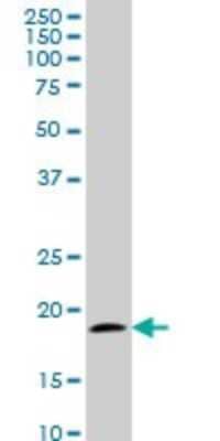 Western Blot: TOMM22 Antibody (4G4) [H00056993-M01]