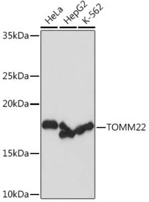 Western Blot: TOMM22 Antibody (6R1L7) [NBP3-16856]