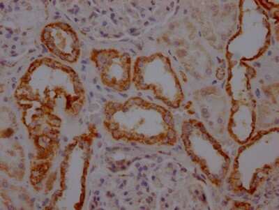 Immunohistochemistry: TOMM22 Antibody (7C11) [NBP3-15219]