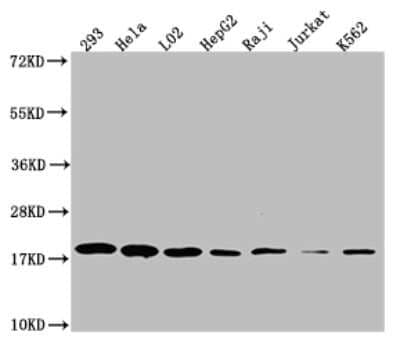 Western Blot: TOMM22 Antibody (7C11) [NBP3-15219]