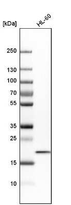 Western Blot: TOMM22 Antibody [NBP1-80671]