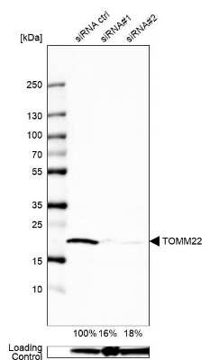 Western Blot: TOMM22 Antibody [NBP1-80671]