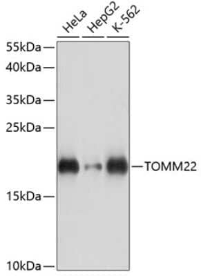 Western Blot: TOMM22 AntibodyAzide and BSA Free [NBP2-93620]