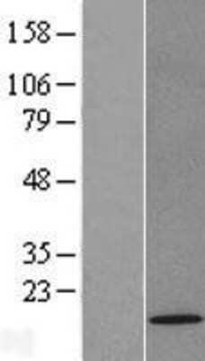 Western Blot: TOMM22 Overexpression Lysate [NBL1-17190]