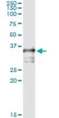 Immunoprecipitation: TOMM34 Antibody (1D2) [H00010953-M02]