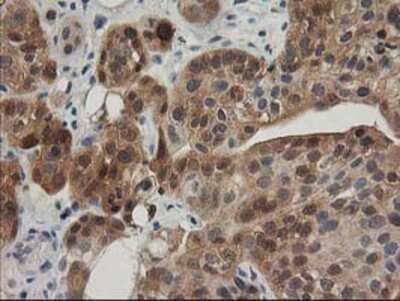 Immunohistochemistry-Paraffin: TOMM34 Antibody (OTI2A9) [NBP2-00892]